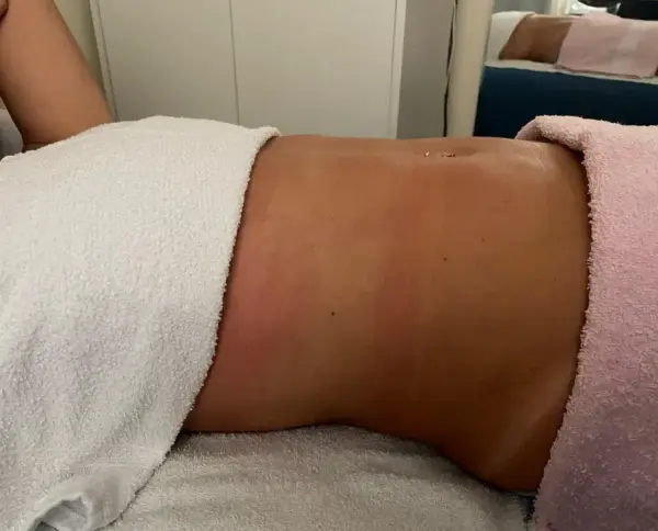 Antes — Massagem modeladora