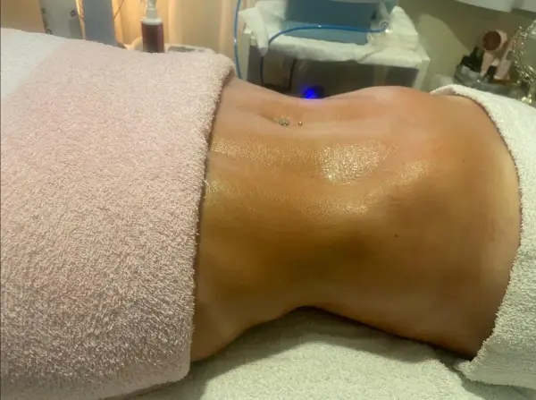 Depois — Massagem modeladora